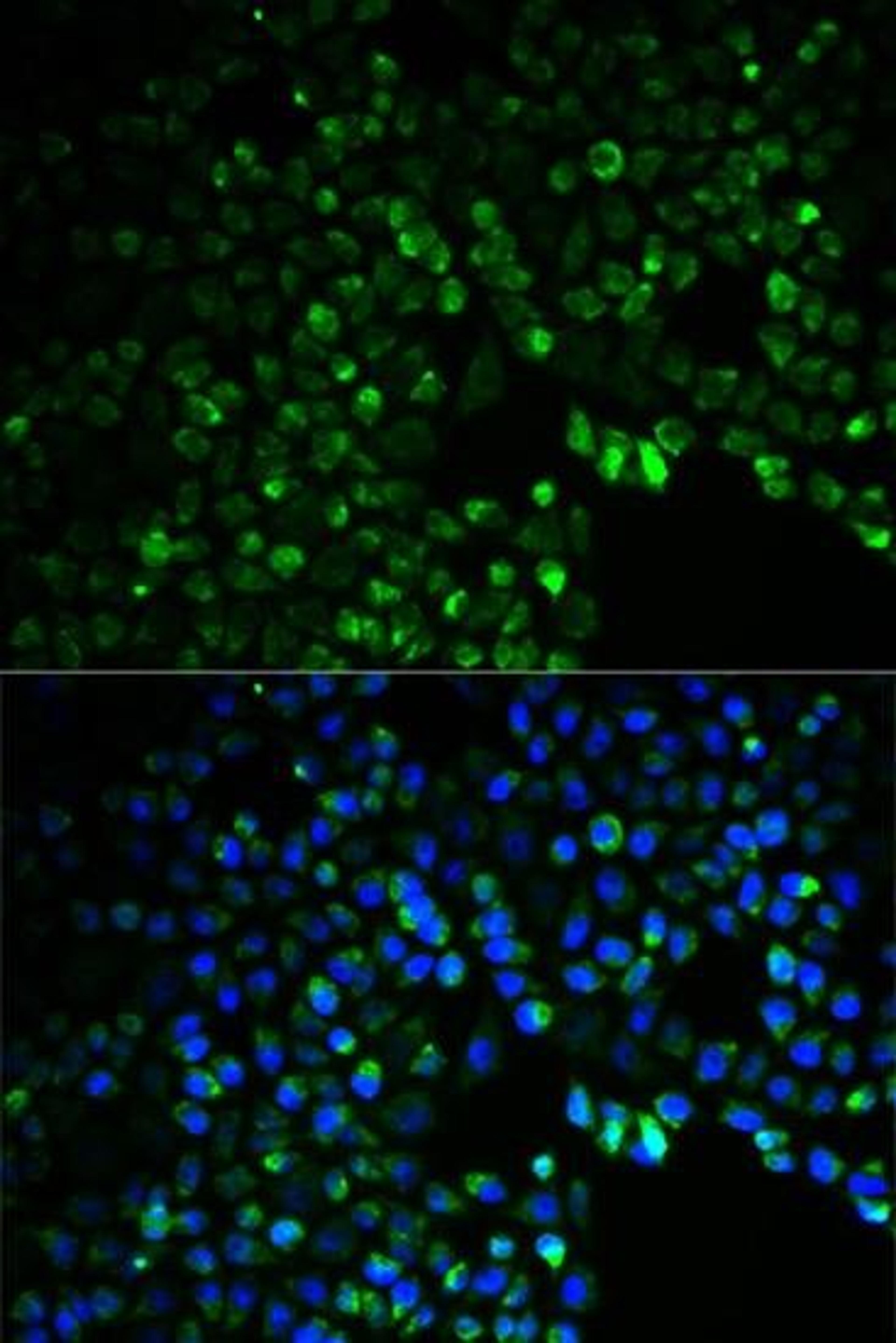 Immunofluorescence analysis of HeLa cell using UGDH antibody