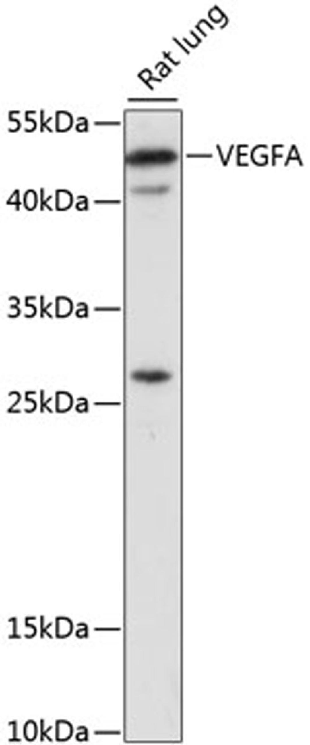 Western blot - VEGFA antibody (A16703)