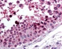 Immunohistochemistry-Paraffin: ROR gamma Antibody [NBP2-24503] - IHC analysis of human testis using NBP2-24503 at 10 ug/ml.