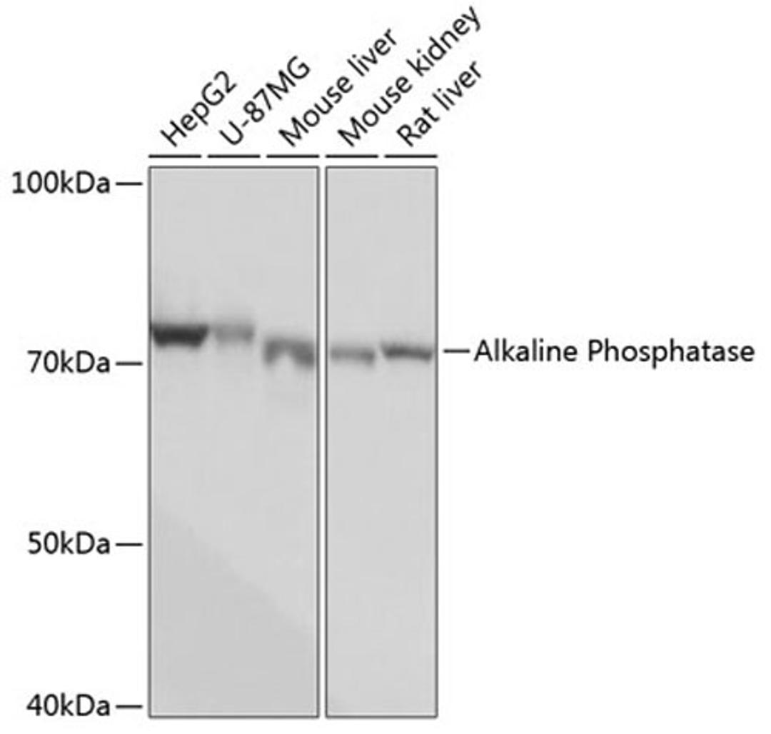 Western blot - Alkaline Phosphatase Rabbit mAb (A0514)