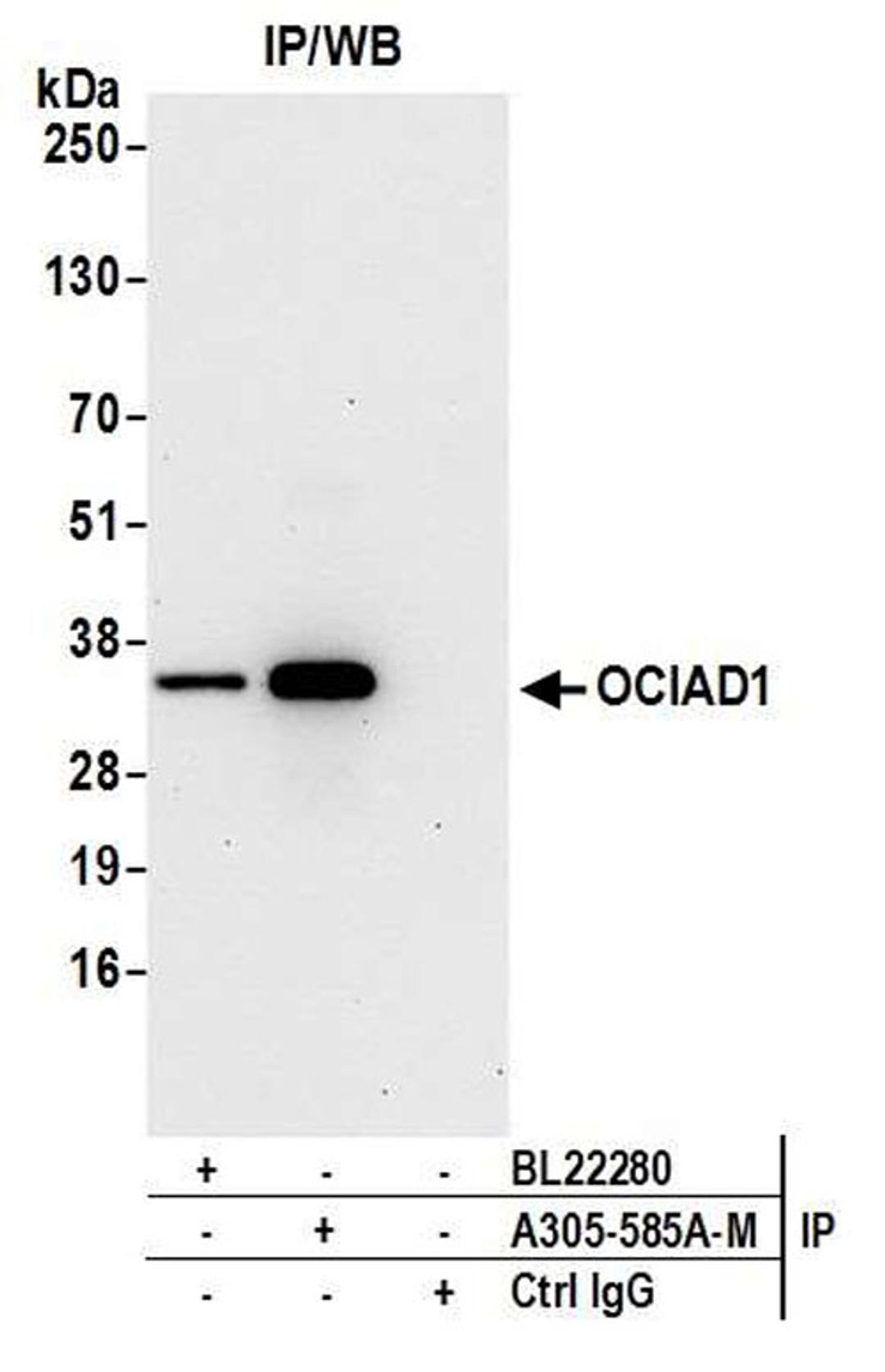 Detection of human OCIAD1 by WB of IP.