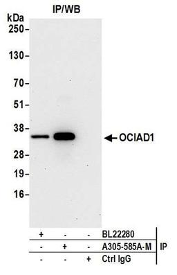 Detection of human OCIAD1 by WB of IP.