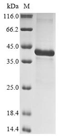 (Tris-Glycine gel) Discontinuous SDS-PAGE (reduced) with 5% enrichment gel and 15% separation gel.