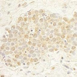 Detection of human WDR20 by immunohistochemistry.