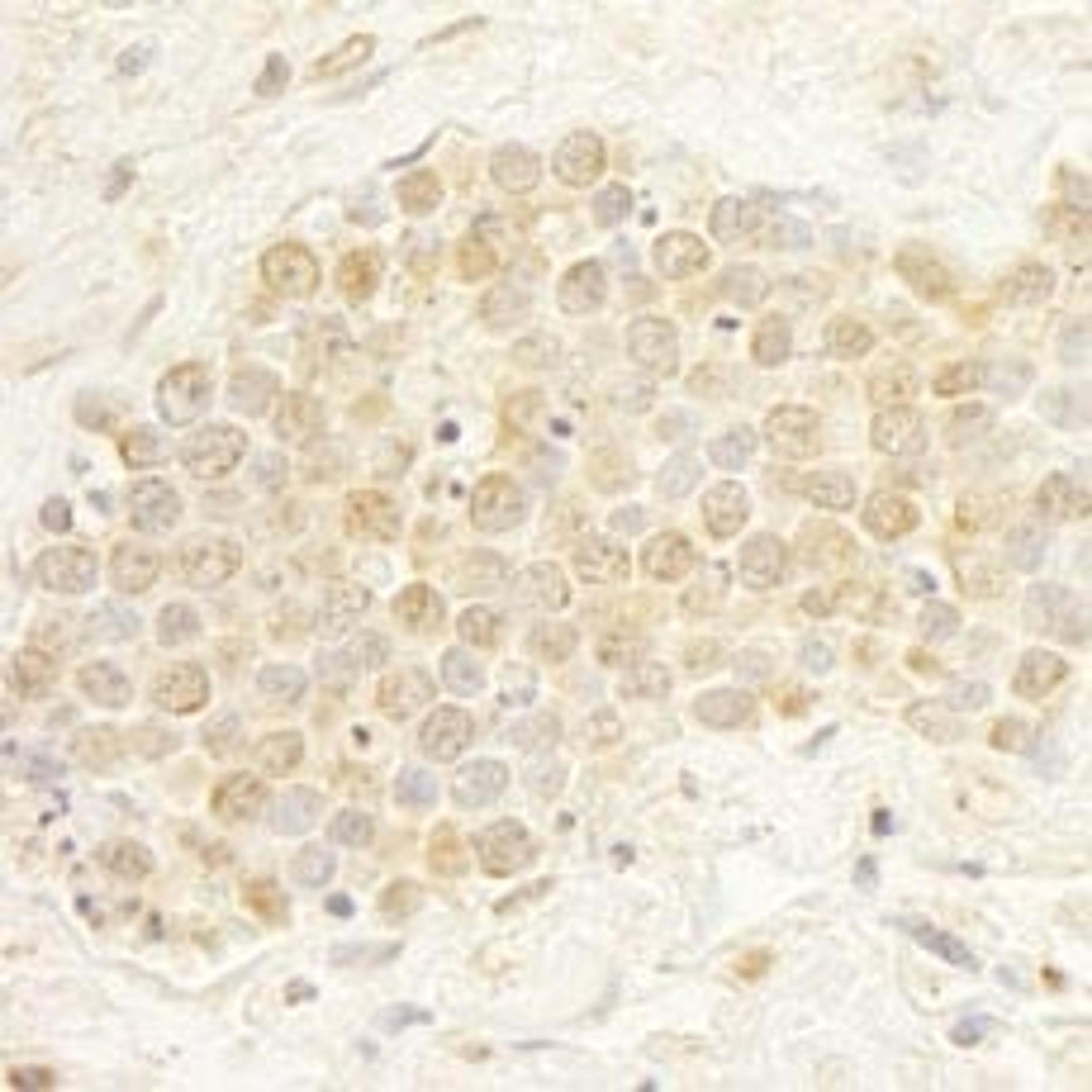 Detection of human WDR20 by immunohistochemistry.