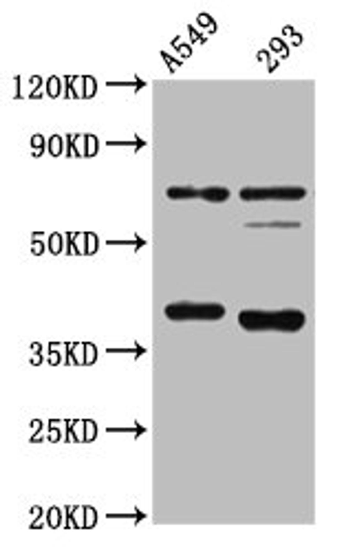 Western Blot. Positive WB detected in: A549 whole cell lysate, 293 whole cell lysate. All lanes: CTSS antibody at 1:4000. Secondary. Goat polyclonal to rabbit IgG at 1/50000 dilution. Predicted band size: 38, 32 kDa. Observed band size: 38 kDa