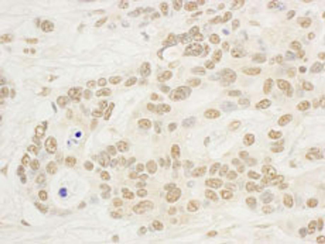 Detection of human NOP132 by immunohistochemistry.