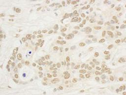 Detection of human NOP132 by immunohistochemistry.