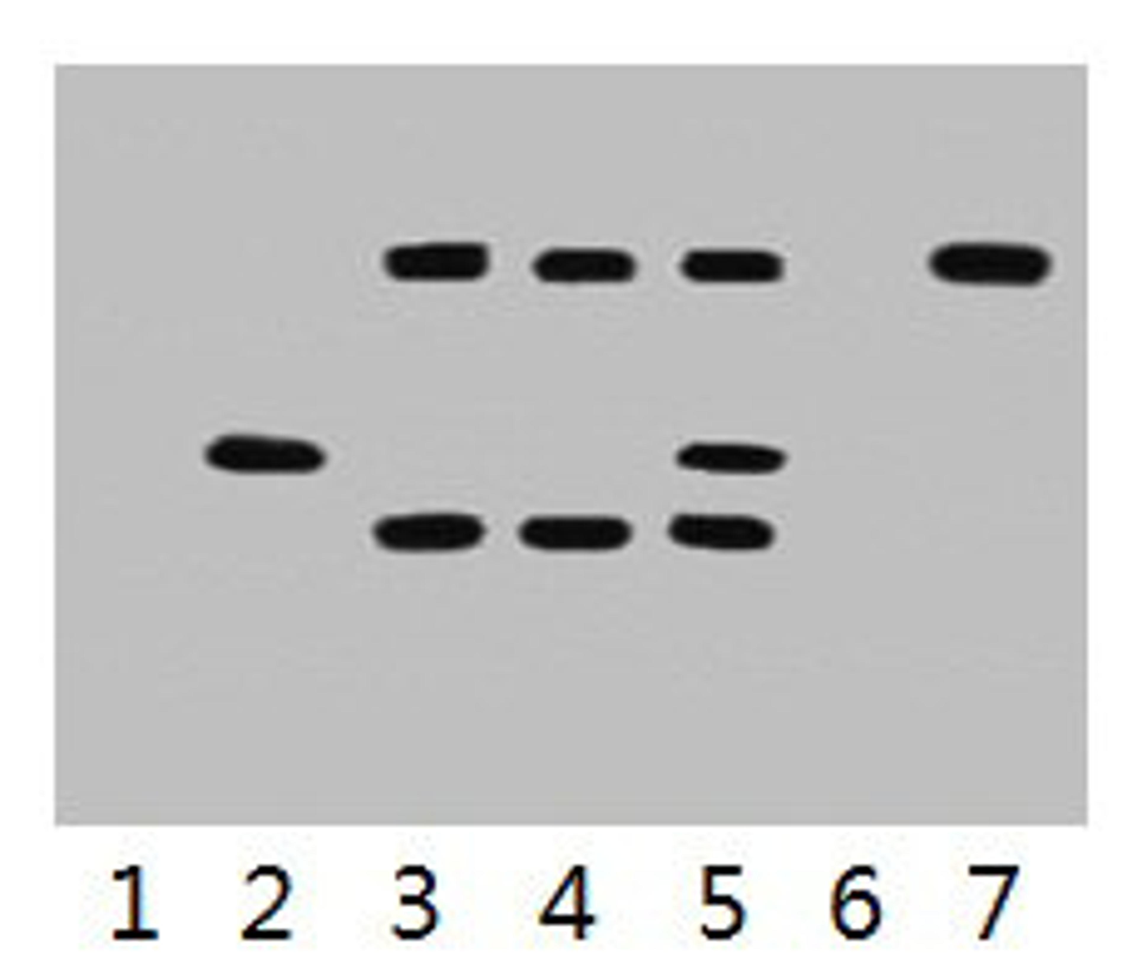 IP antibody use: 5µg VSV-G Mouse IgG1 per ml Lysate, WB 1:5000. Lane 1: untransfected 293 cell lysate. Lane 2: transfected 293 cell lysate with VSV-G-tag fusion protein. Lane 3: IP (untransfted 293 + anti-VSV-G mAb + Protein G agarose). Lane 4: IP (transfected 293 + normal Mouse IgG + Protein G agarose). Lane 5: IP (transfected 293 + anti-VSV-G mAb + Protein G agarose). Lane 6: IP (transfected 293 + Protein G). Lane 7: Recombinant protein (E.coli). 