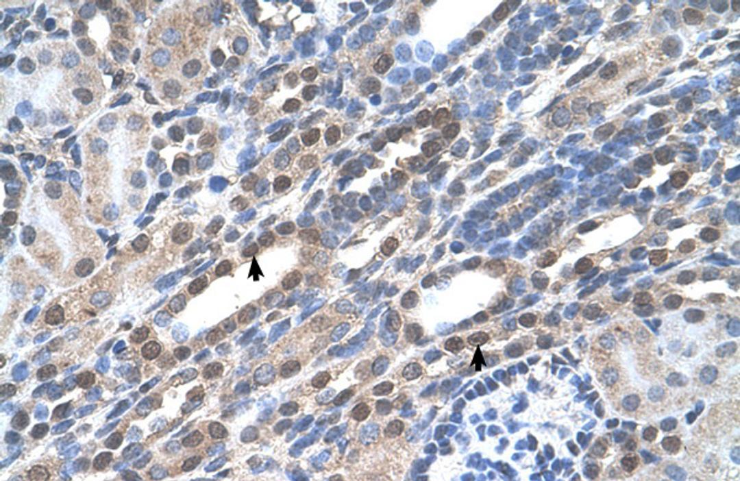 Antibody used in IHC on Human kidney.