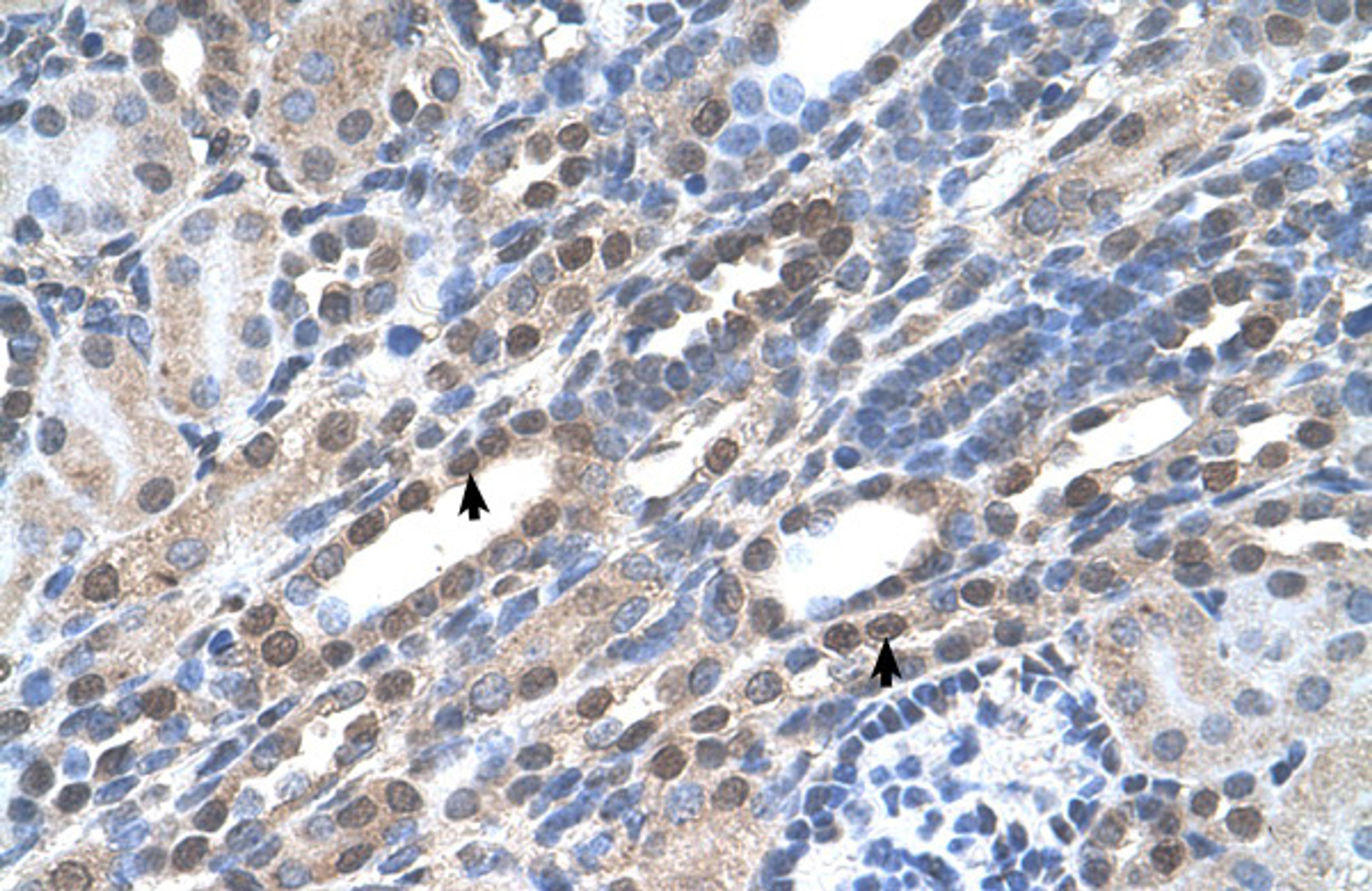 Antibody used in IHC on Human kidney.