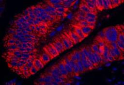 Detection of human ARHGEF5 by immunohistochemistry.