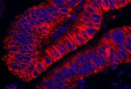 Detection of human ARHGEF5 by immunohistochemistry.