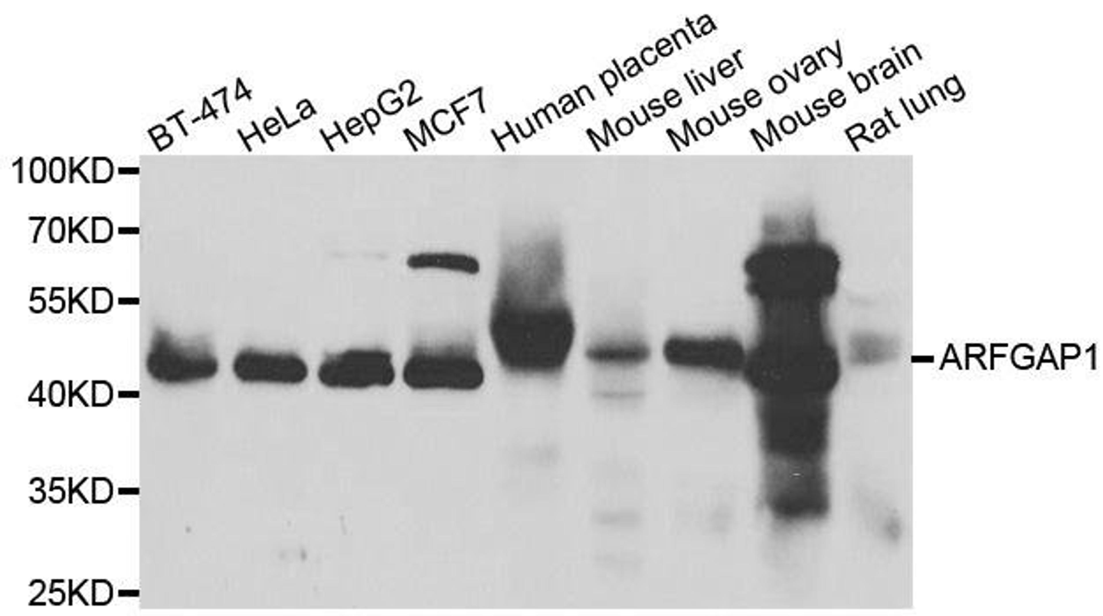 Western blot analysis of extracts of various cell lines using ARFGAP1 antibody