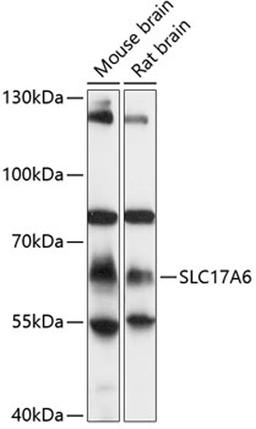 Western blot - SLC17A6 antibody (A13648)