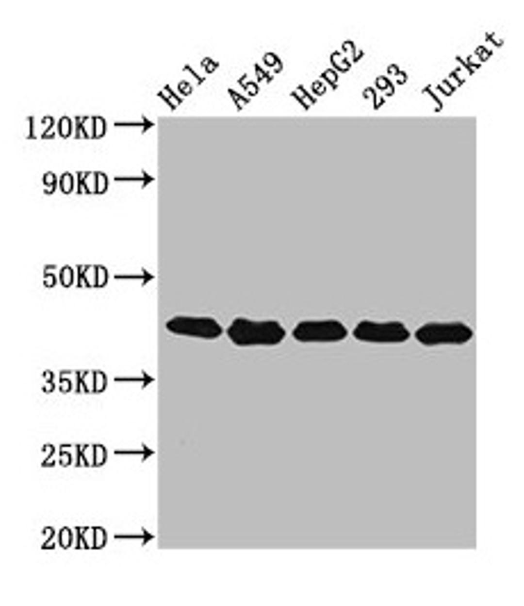 Western Blot. Positive WB detected in: Hela whole cell lysate, A549 whole cell lysate, HepG2 whole cell lysate, 293 whole cell lysate, Jurkat whole cell lysate. All lanes: POLDIP3 antibody at 3.2ug/ml. Secondary. Goat polyclonal to rabbit IgG at 1/50000 dilution. Predicted band size: 47, 43 kDa. Observed band size: 43 kDa. 
