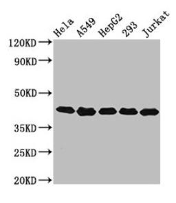 Western Blot. Positive WB detected in: Hela whole cell lysate, A549 whole cell lysate, HepG2 whole cell lysate, 293 whole cell lysate, Jurkat whole cell lysate. All lanes: POLDIP3 antibody at 3.2ug/ml. Secondary. Goat polyclonal to rabbit IgG at 1/50000 dilution. Predicted band size: 47, 43 kDa. Observed band size: 43 kDa. 