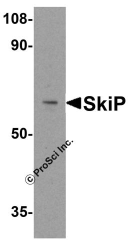 Western blot analysis of SkiP in mouse skeletal muscle tissue lysate with SkiP antibody at 0.5 &#956;g/ml.