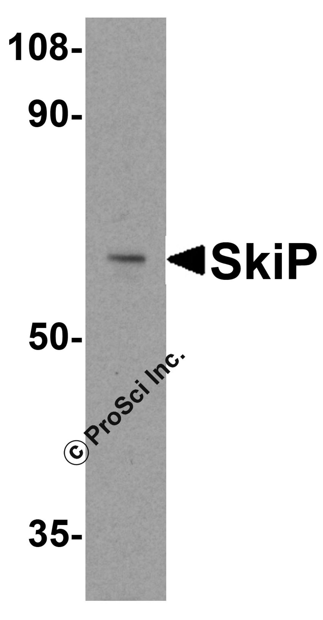 Western blot analysis of SkiP in mouse skeletal muscle tissue lysate with SkiP antibody at 0.5 μg/ml.