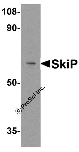 Western blot analysis of SkiP in mouse skeletal muscle tissue lysate with SkiP antibody at 0.5 μg/ml.