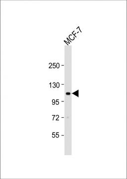 Western Blot at 1:1000 dilution + MCF-7 whole cell lysate Lysates/proteins at 20 ug per lane.