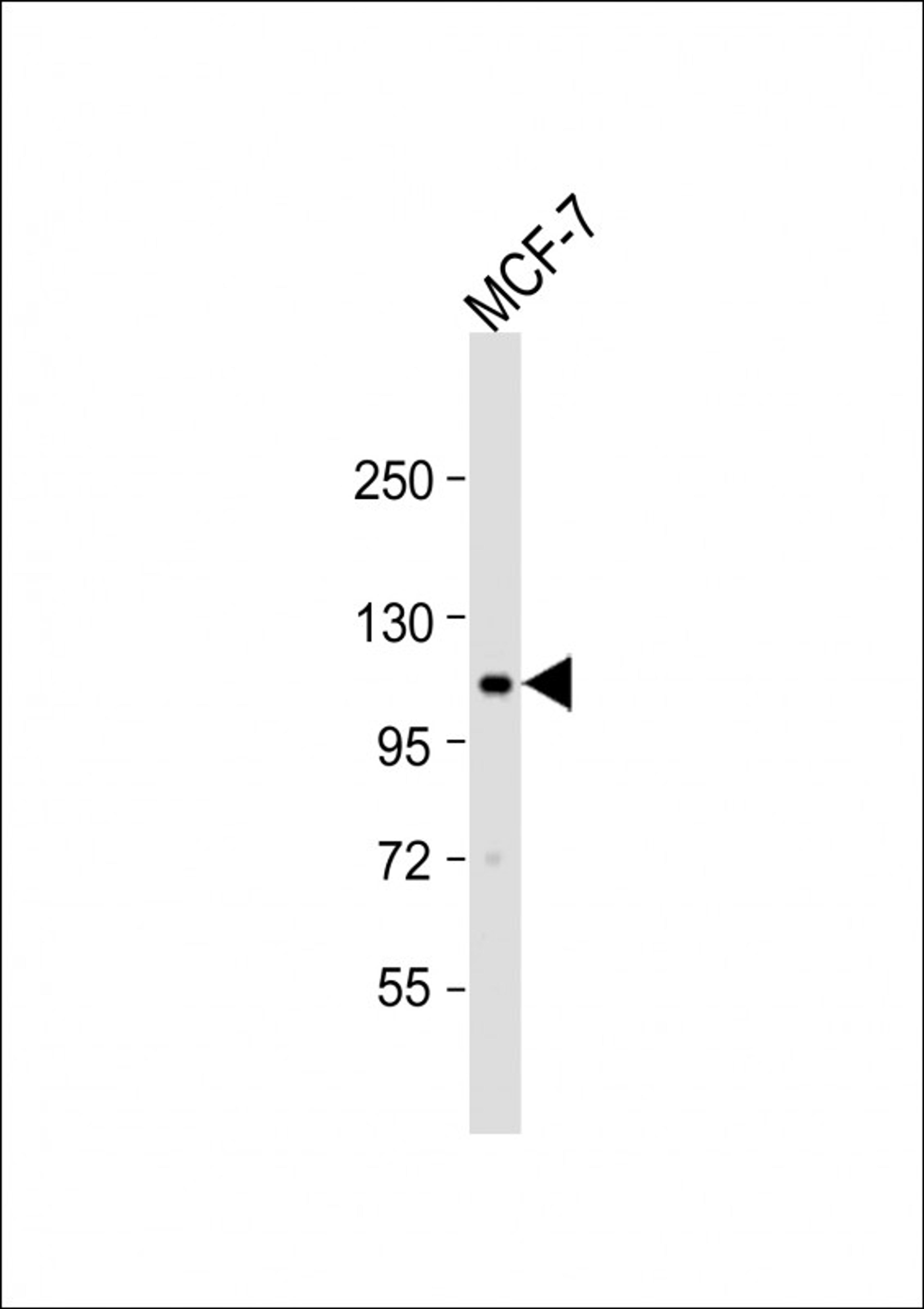 Western Blot at 1:1000 dilution + MCF-7 whole cell lysate Lysates/proteins at 20 ug per lane.