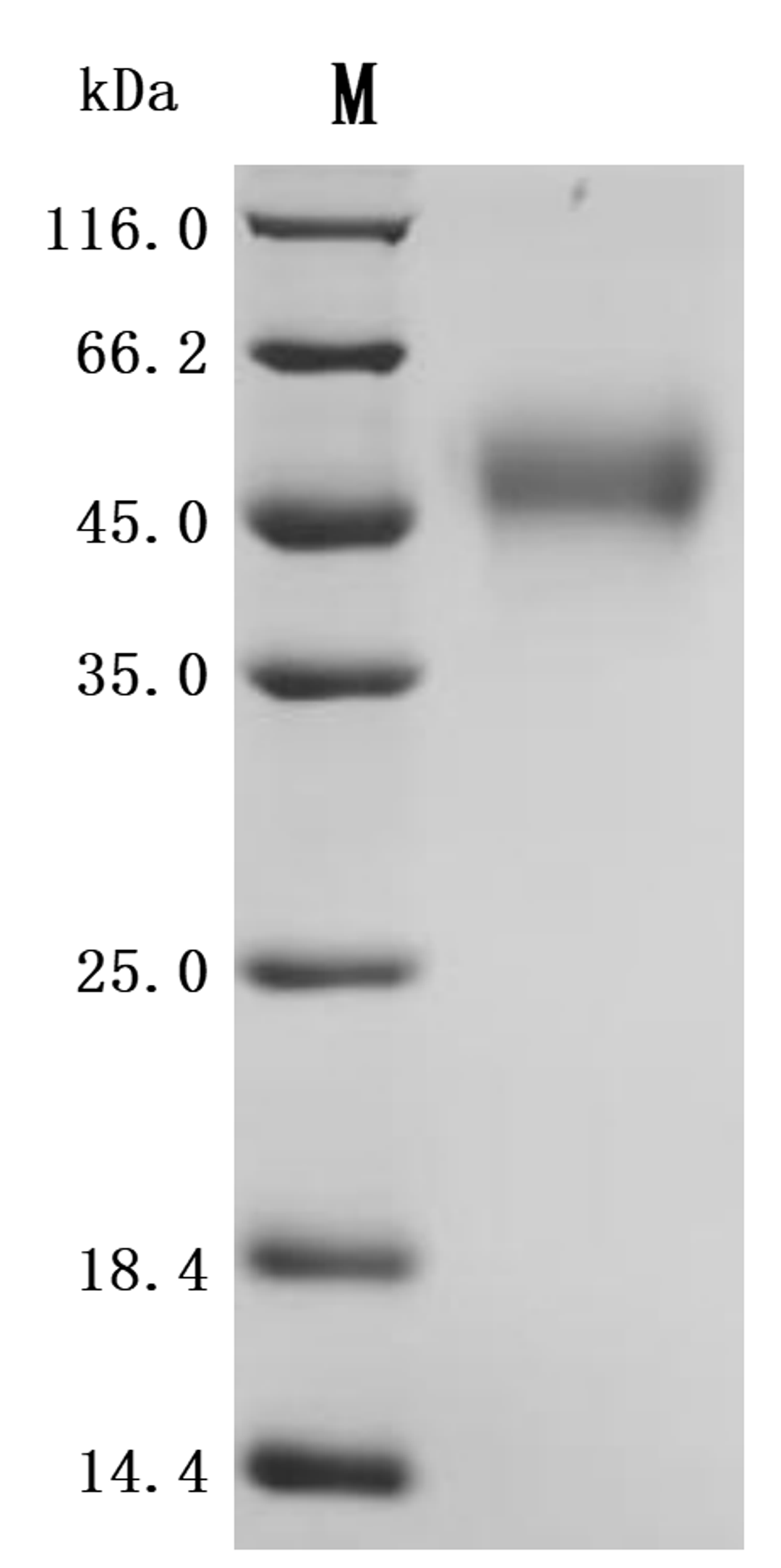(Tris-Glycine gel) Discontinuous SDS-PAGE (reduced) with 5% enrichment gel and 15% separation gel.