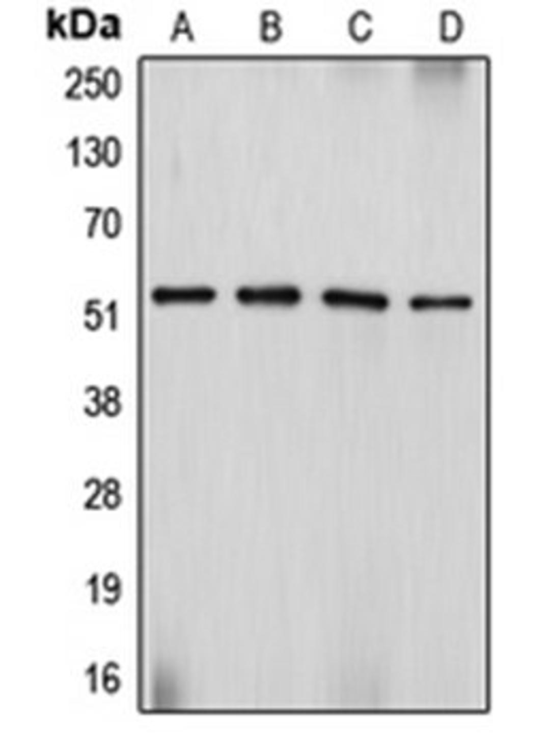 Western blot analysis of Sol8 (Lane 1), HeLa (Lane 2), SJRH30 (Lane 3), PC12 (Lane 4) whole cell lysates using DES antibody