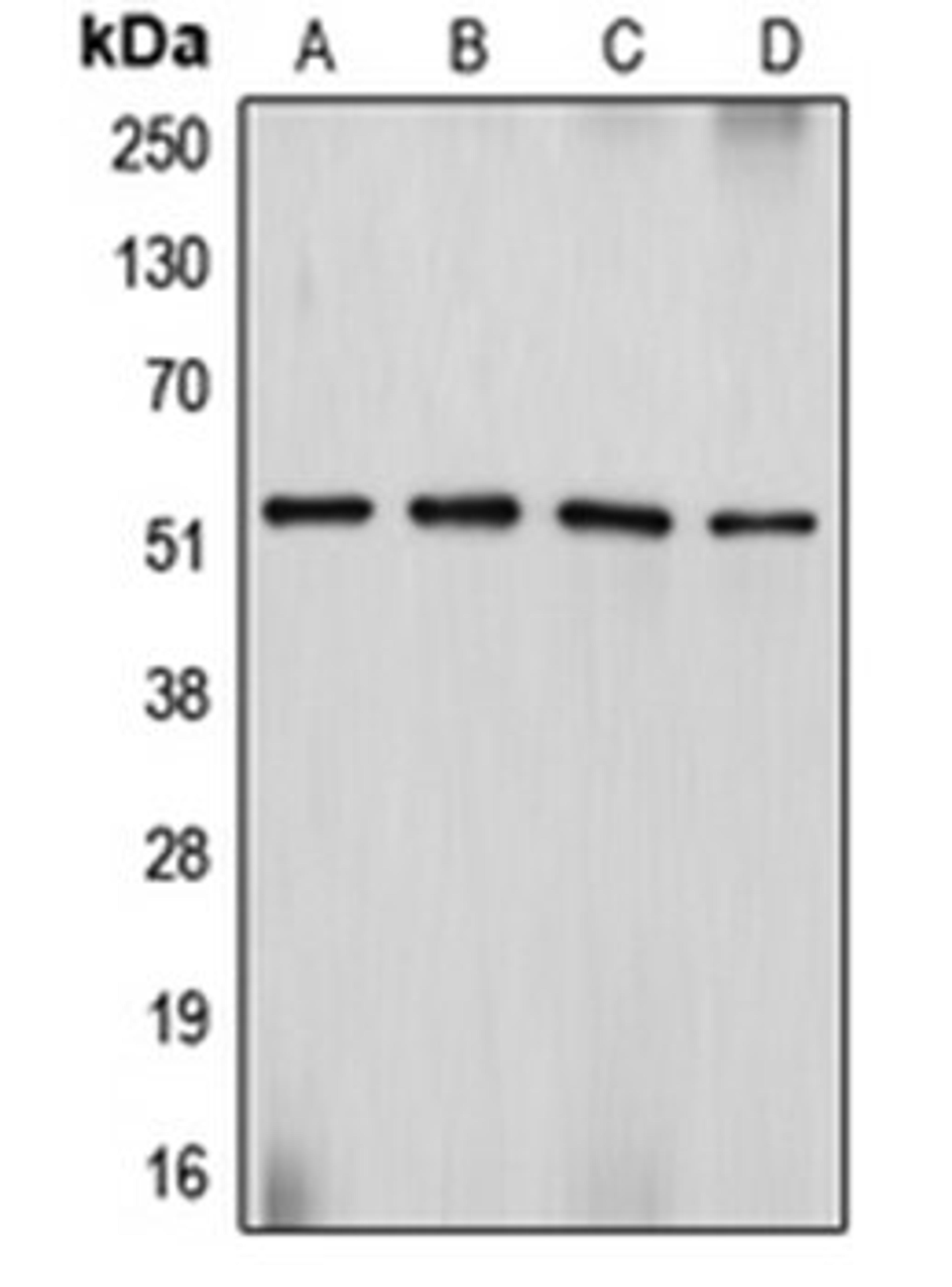 Western blot analysis of Sol8 (Lane 1), HeLa (Lane 2), SJRH30 (Lane 3), PC12 (Lane 4) whole cell lysates using DES antibody