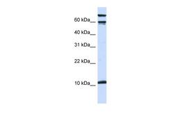 Antibody used in WB on Human HEK293T cells at 0.2-1 ug/ml.