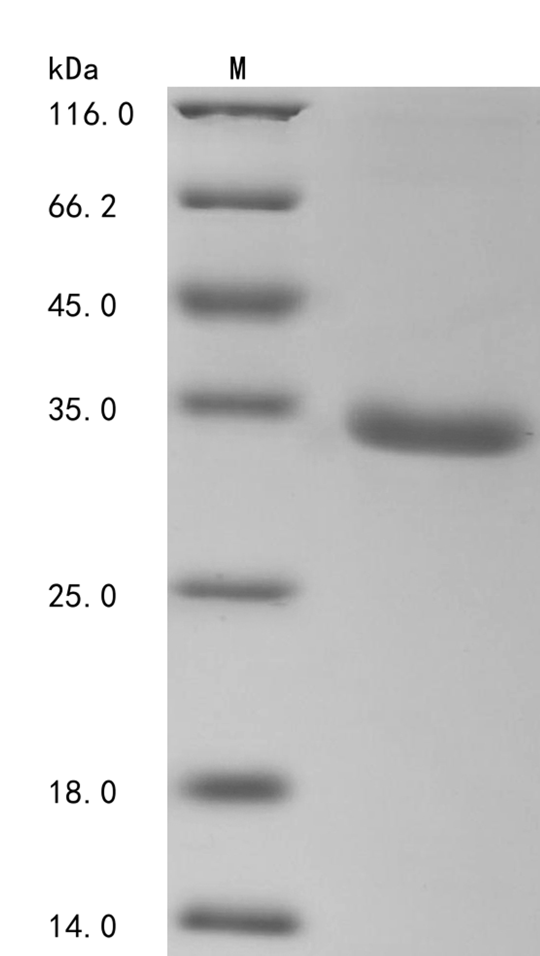 (Tris-Glycine gel) Discontinuous SDS-PAGE (reduced) with 5% enrichment gel and 15% separation gel.