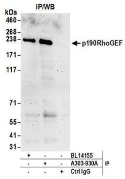 Detection of human p190RhoGEF by western blot of immunoprecipitates.