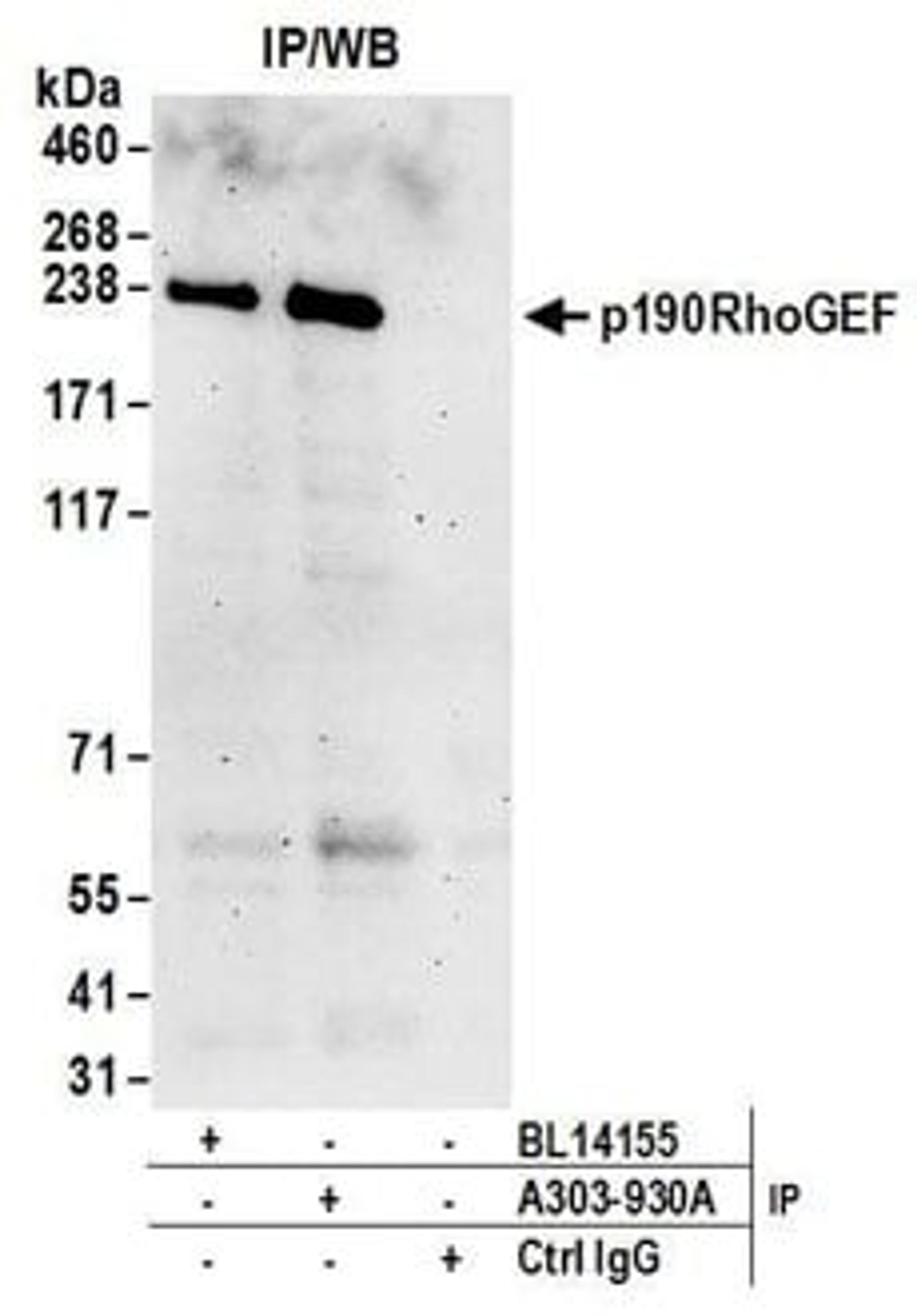 Detection of human p190RhoGEF by western blot of immunoprecipitates.