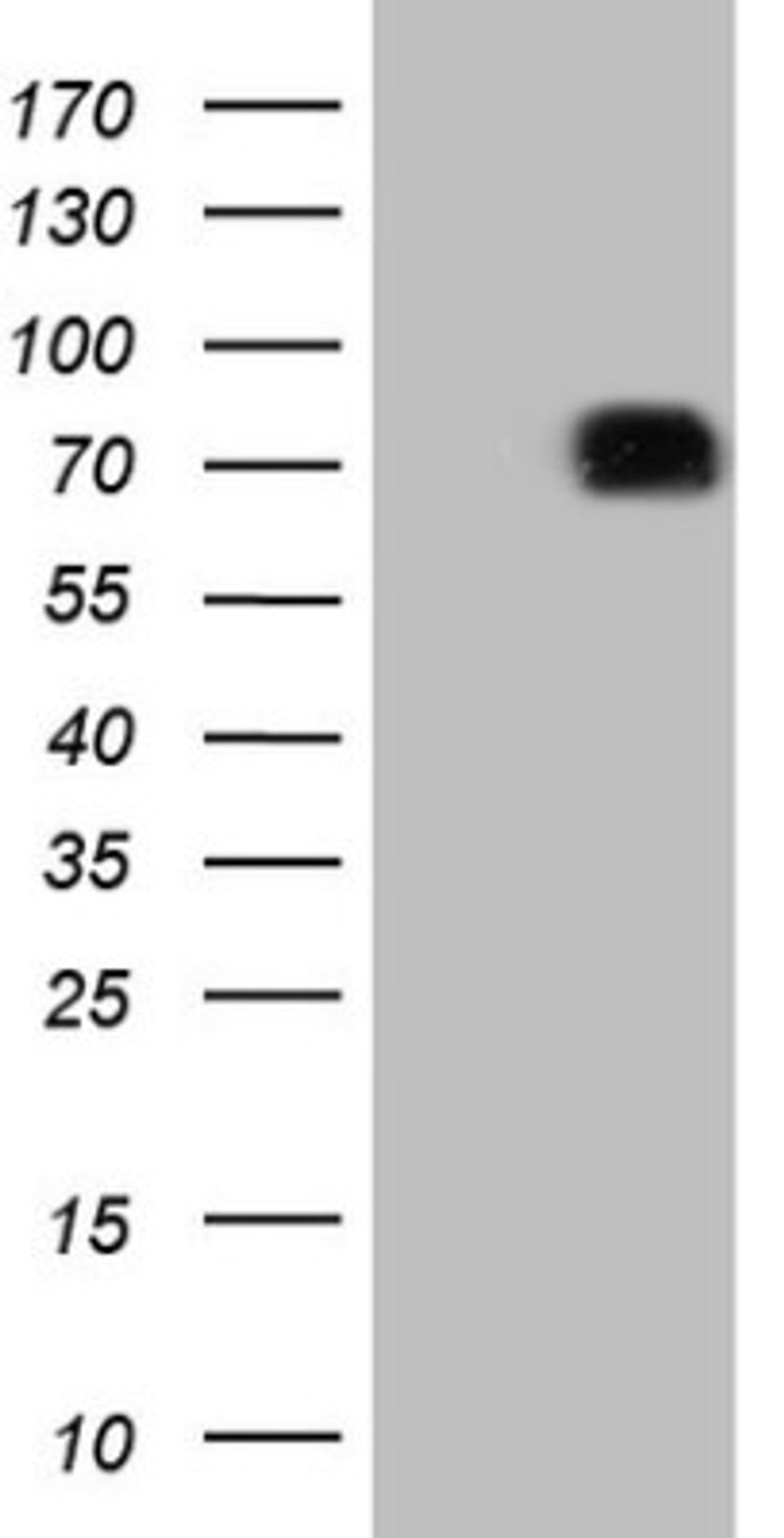 Western Blot: SIRP alpha/CD172a Antibody (7B3) [NBP2-45849] - Analysis of HEK293T cells were transfected with the pCMV6-ENTRY control (Left lane) or pCMV6-ENTRY SIRP alpha.