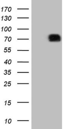 Western Blot: SIRP alpha/CD172a Antibody (7B3) [NBP2-45849] - Analysis of HEK293T cells were transfected with the pCMV6-ENTRY control (Left lane) or pCMV6-ENTRY SIRP alpha.