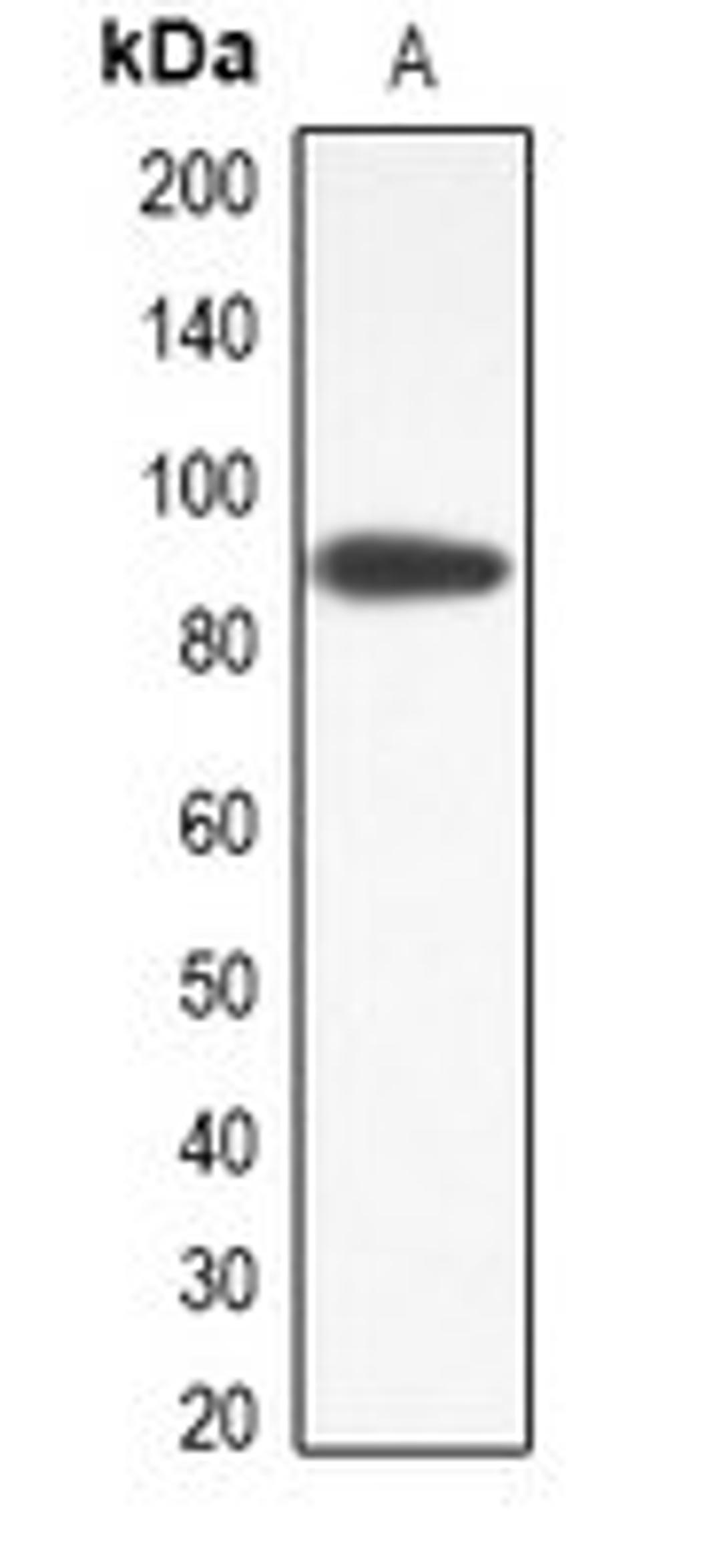 Western blot analysis of RAW264.7 (Lane1) whole cell lysates using ANO9 antibody