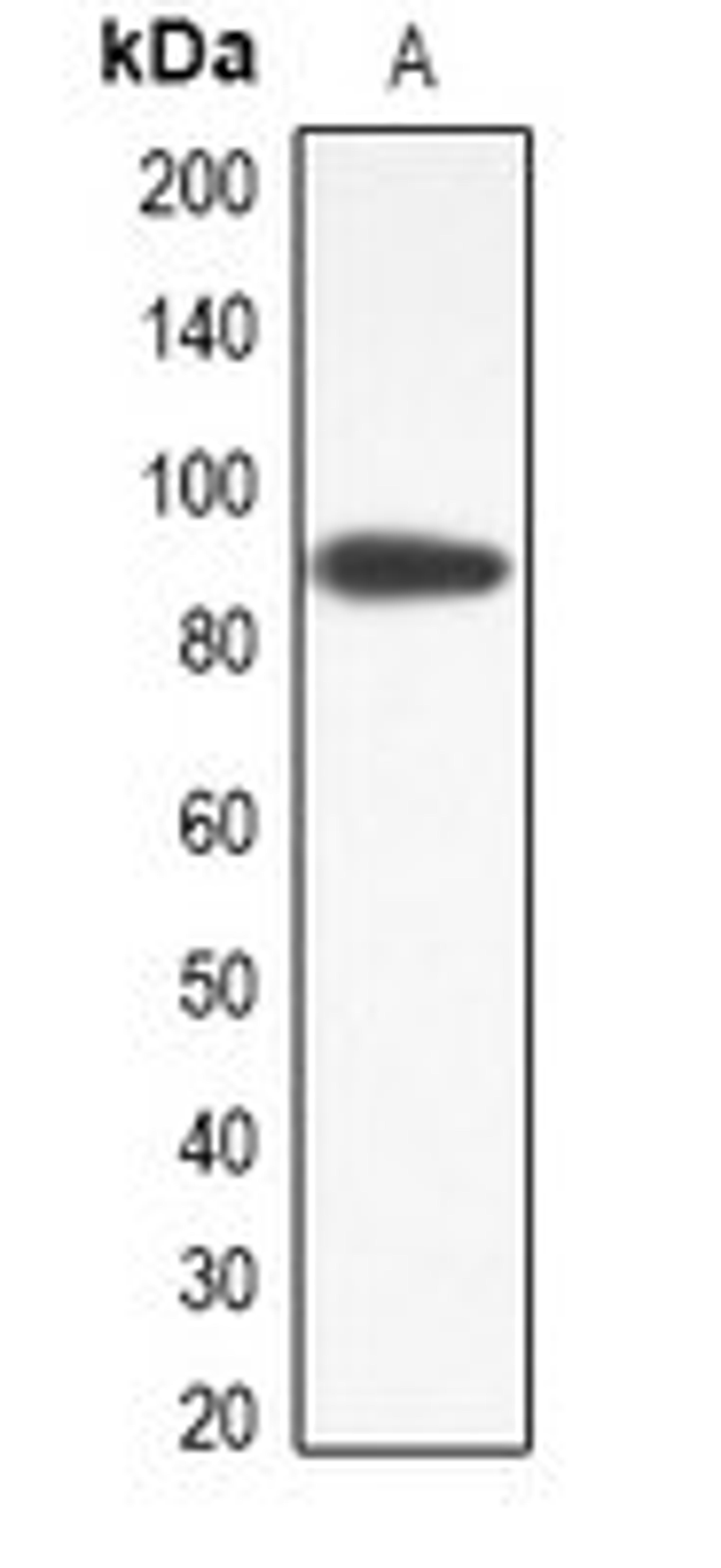 Western blot analysis of RAW264.7 (Lane1) whole cell lysates using ANO9 antibody