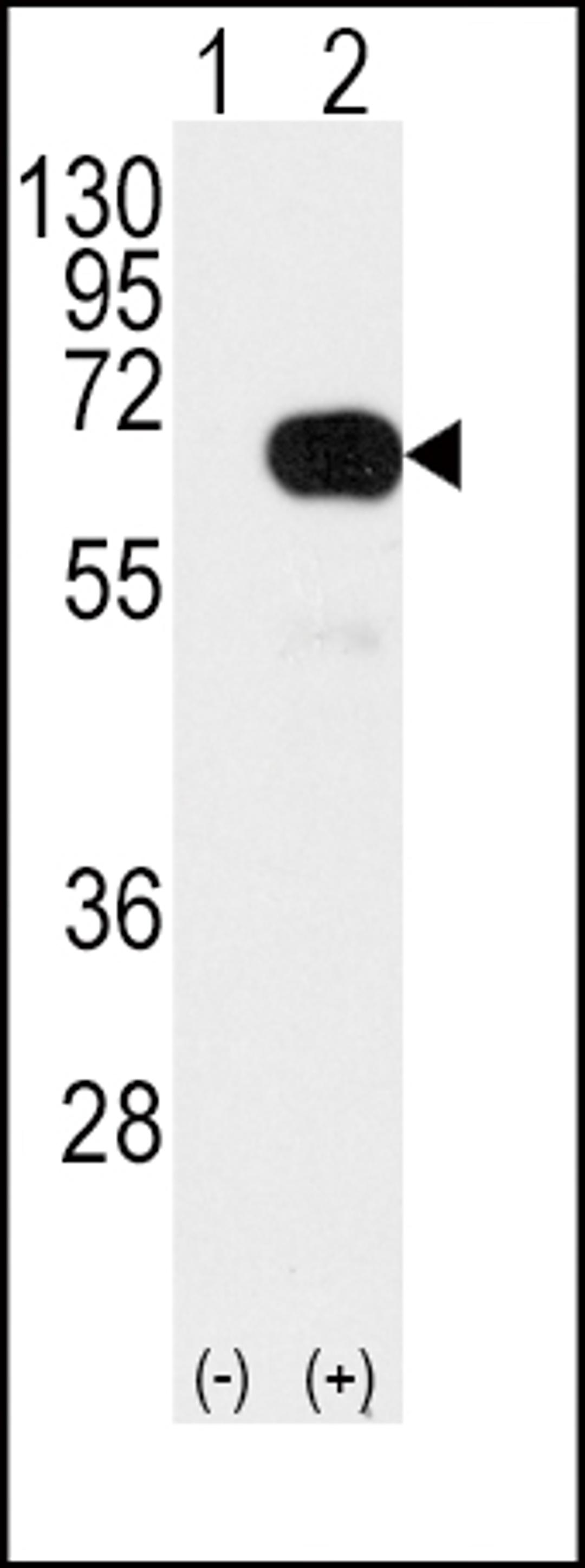 Western blot analysis of SMAD4 Antibody (T277) using rabbit polyclonal SMAD4 Antibody (T277) using 293 cell lysates (2 ug/lane) either nontransfected (Lane 1) or transiently transfected with the SMAD4 gene (Lane 2).