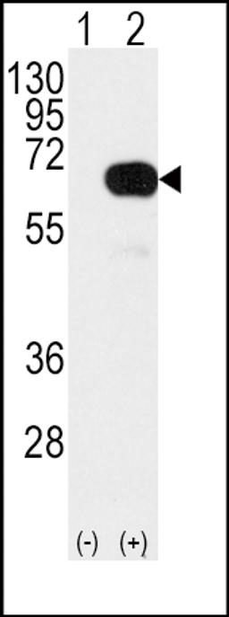 Western blot analysis of SMAD4 Antibody (T277) using rabbit polyclonal SMAD4 Antibody (T277) using 293 cell lysates (2 ug/lane) either nontransfected (Lane 1) or transiently transfected with the SMAD4 gene (Lane 2).