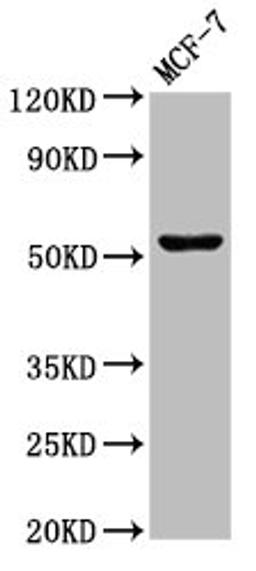 Western Blot. Positive WB detected in: MCF-7 whole cell lysate. All lanes: CHKA antibody at 3µg/ml. Secondary. Goat polyclonal to rabbit IgG at 1/50000 dilution. Predicted band size: 53, 51 kDa. Observed band size: 53 kDa
