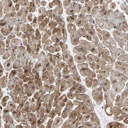 Immunohistochemistry-Paraffin: SLC6A17 Antibody [NBP1-86123] - Staining of human heart muscle shows strong nuclear and cytoplasmic positivity in myocytes.