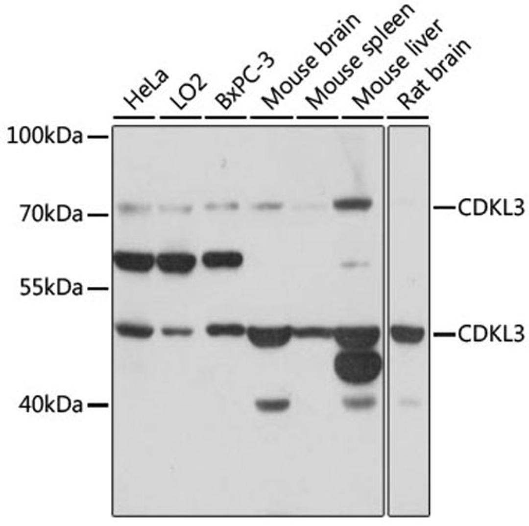 Western blot - CDKL3 antibody (A16689)