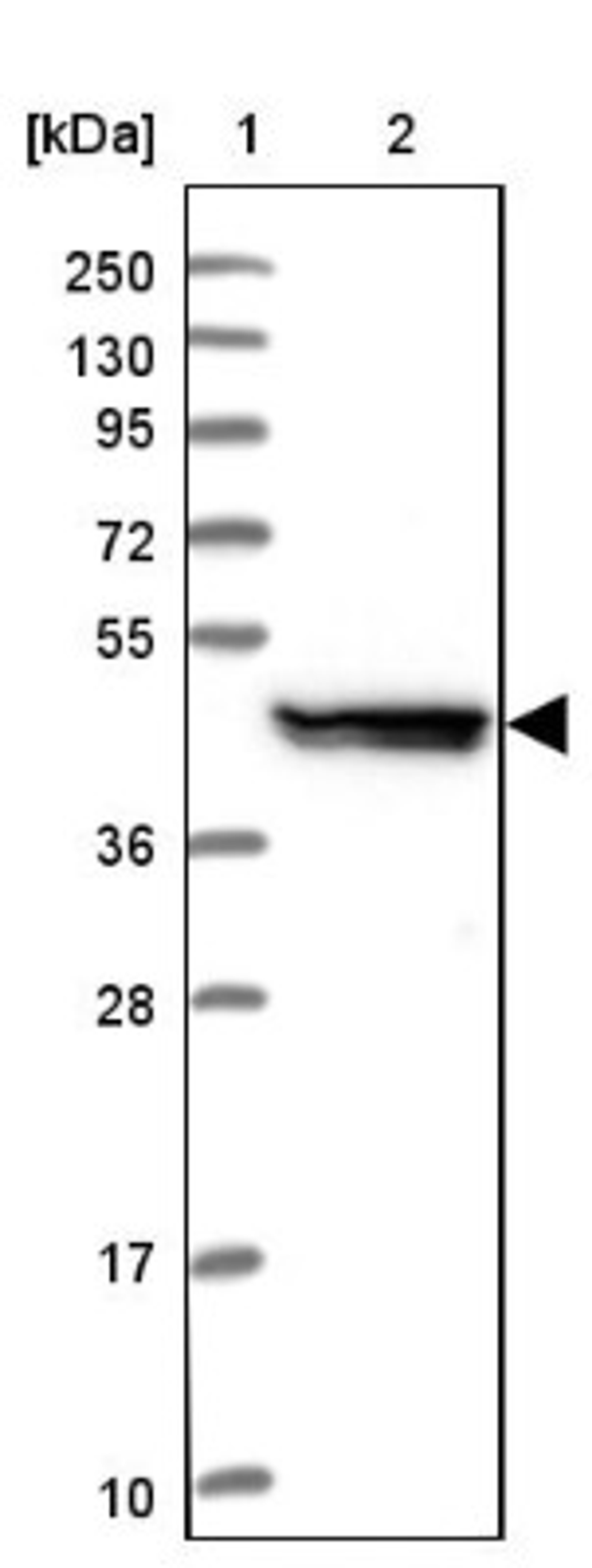 Western Blot: UAP1L1 Antibody [NBP1-92555] - Lane 1: Marker [kDa] 250, 130, 95, 72, 55, 36, 28, 17, 10<br/>Lane 2: Human cell line RT-4