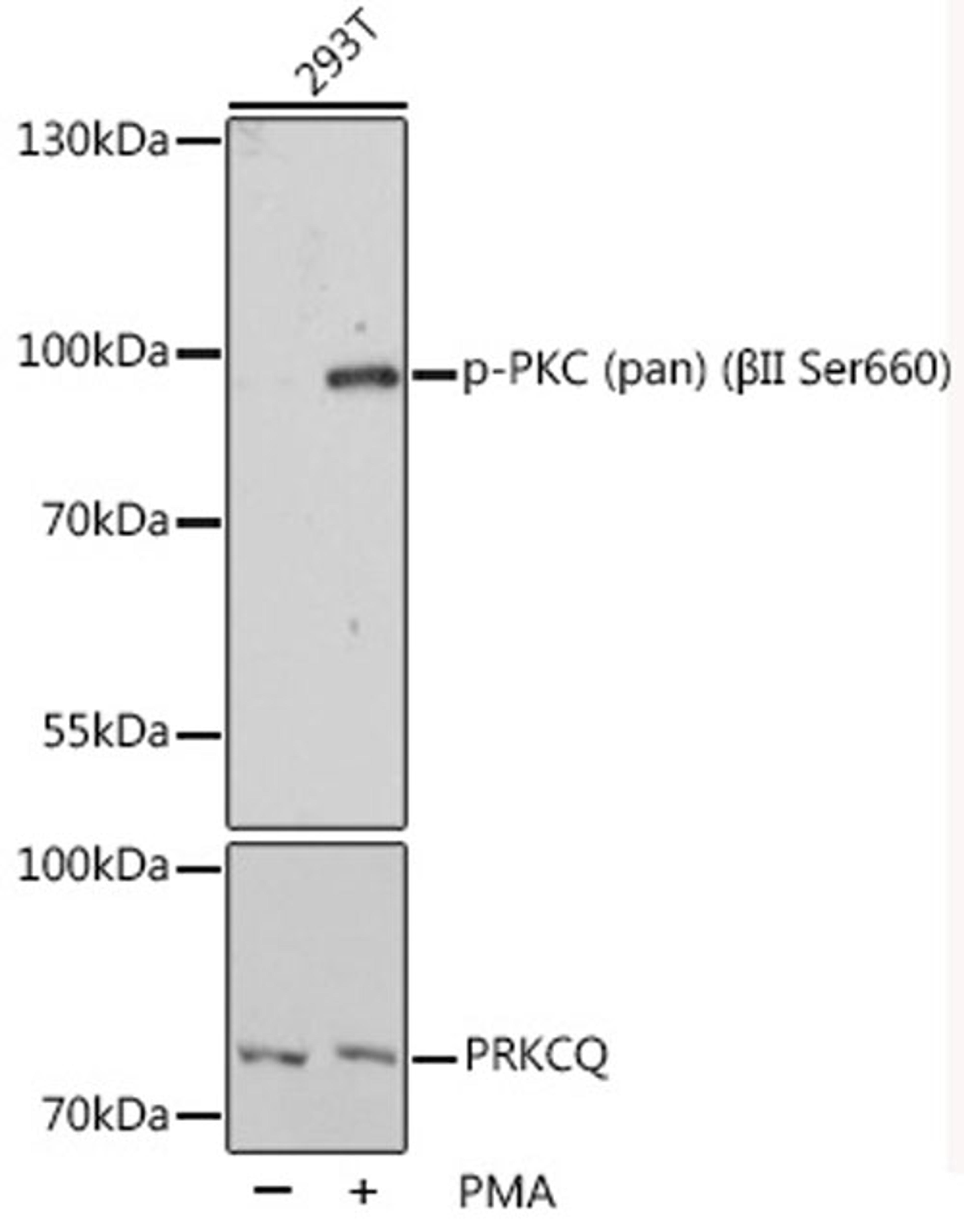 Western blot - Phospho-PKC (pan) (ßII Ser660) pAb (AP0495)