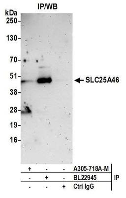 Detection of human SLC25A46 by WB of IP.