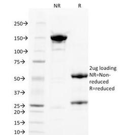 SDS-PAGE Analysis of Purified, BSA-Free PLGF Antibody (clone PLGF/93). Confirmation of Integrity and Purity of the Antibody.