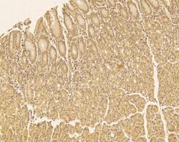 Immunohistochemistry-Frozen: TREX1 Antibody [NBP2-29617] - IHC analysis of formalin-fixed paraffin-embedded tissue section of human normal stomach using rabbit polyclonal TREX1 antibody at 7.5 ug/ml concentration. Specific cytoplasmic and nuclear staining was observed in the glandular cells/mucosal epithelium of stomach [Magnification 10X].