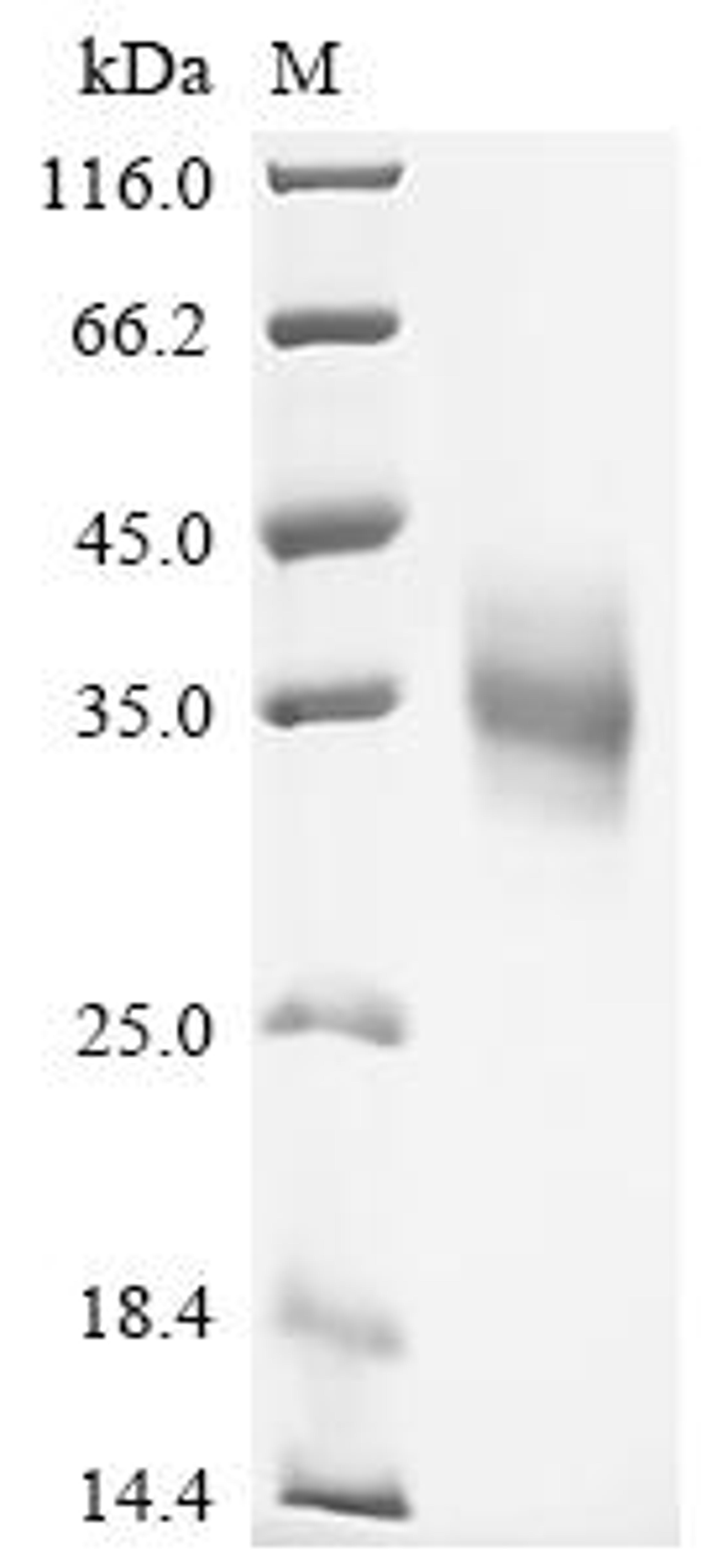 (Tris-Glycine gel) Discontinuous SDS-PAGE (reduced) with 5% enrichment gel and 15% separation gel.