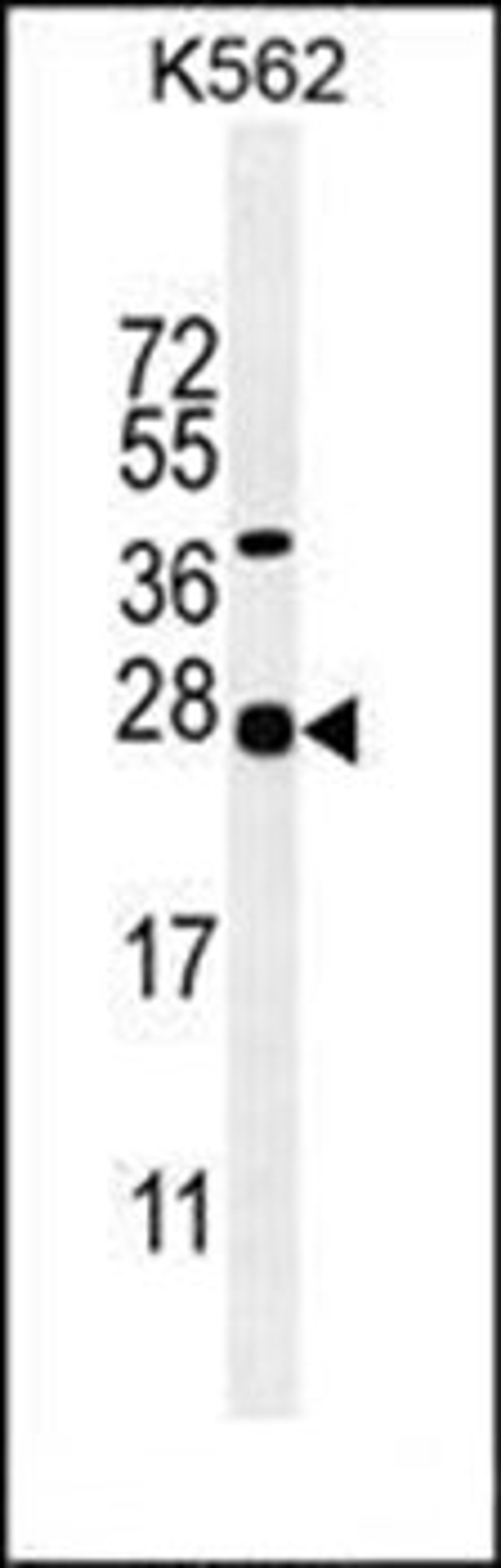 Western blot analysis of K562 cell line lysates (35ug/lane) using GAL antibody (Center)