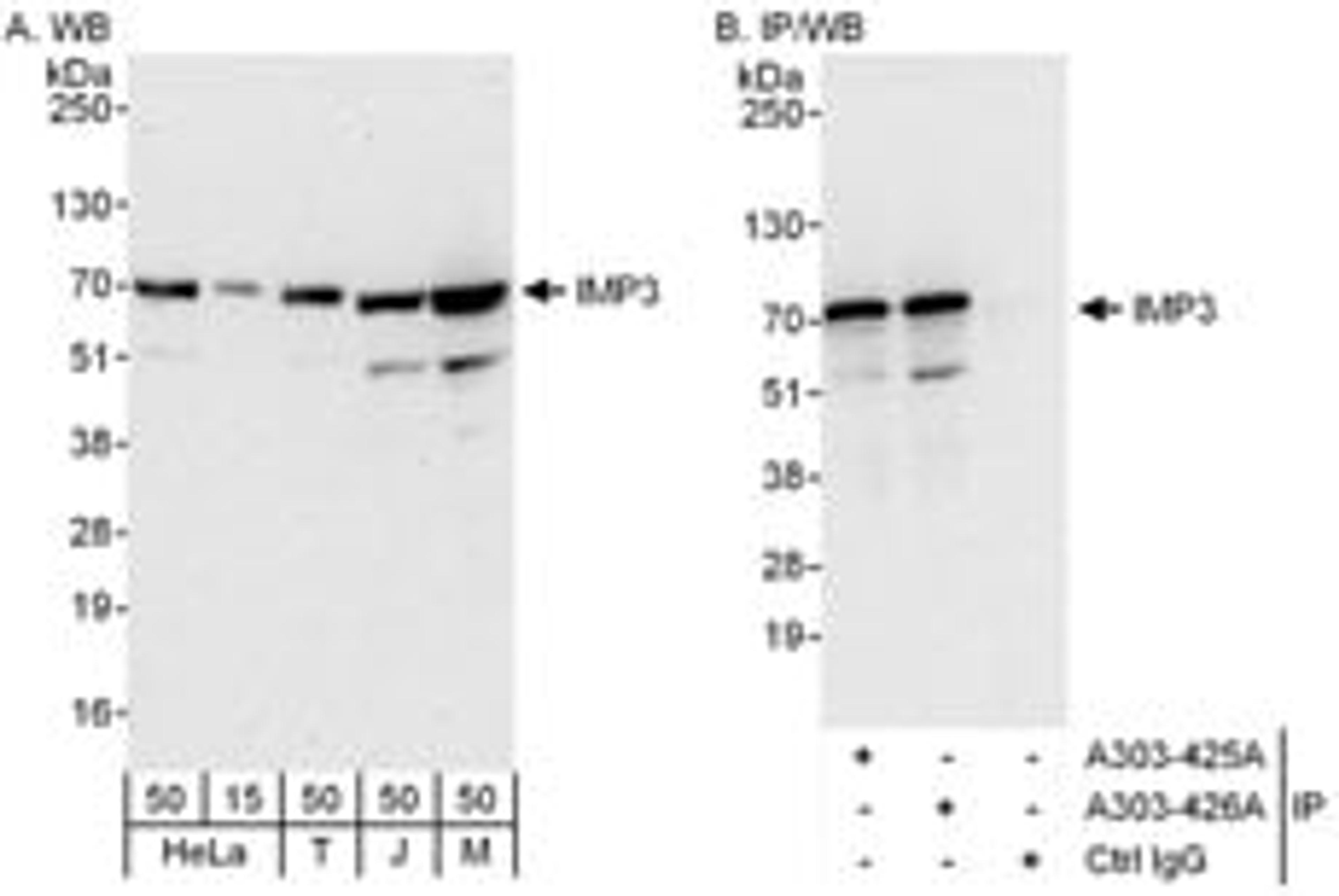 Detection of human and mouse IMP3 by western blot (h and m) and immunoprecipitation (h).